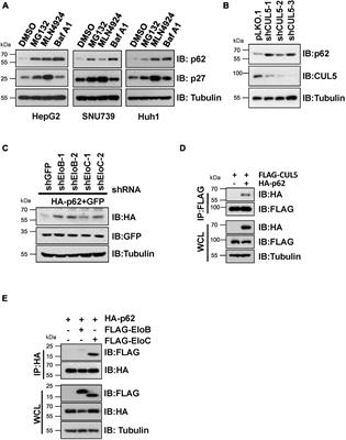 CUL5–ASB6 Complex Promotes p62/SQSTM1 Ubiquitination and Degradation to Regulate Cell Proliferation and Autophagy